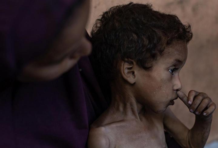 Gazze’de 86 kişi açlıktan hayatını kaybetti