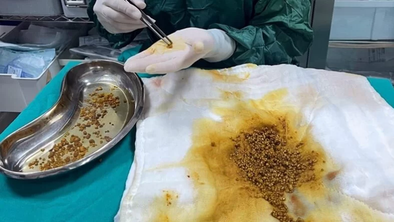 dc87df89-ef36-4953-b1a8-d2aa2d498bad